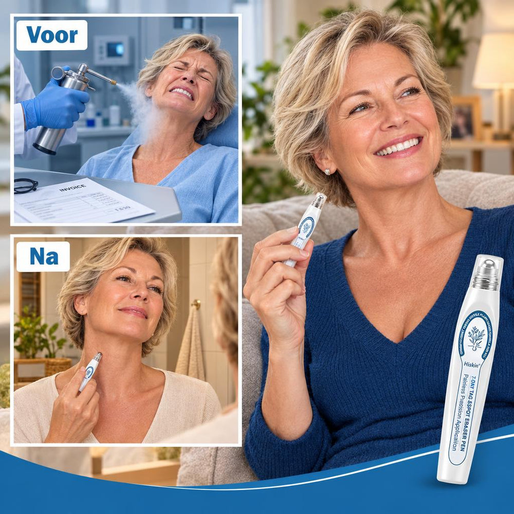 Sla De Stikstof Over – Geen Wachtkamer, Geen Mesje, Geen Rekening Per Plekje