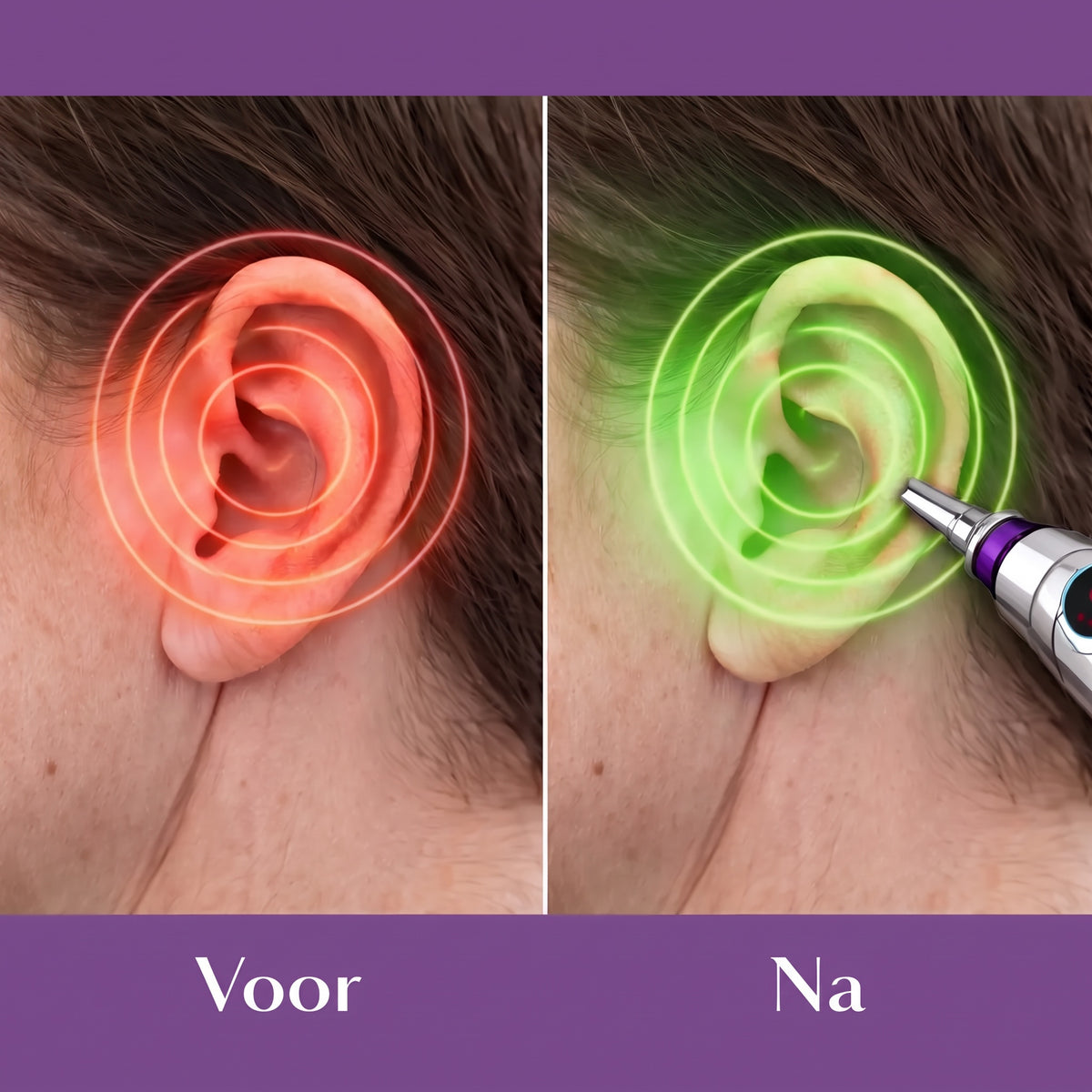 Voor en na OorRust
