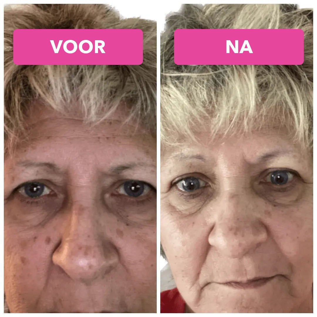 GloedRust vitamine C serum