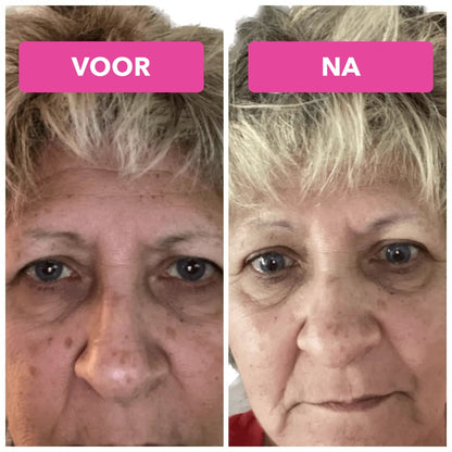GloedRust vitamine C serum