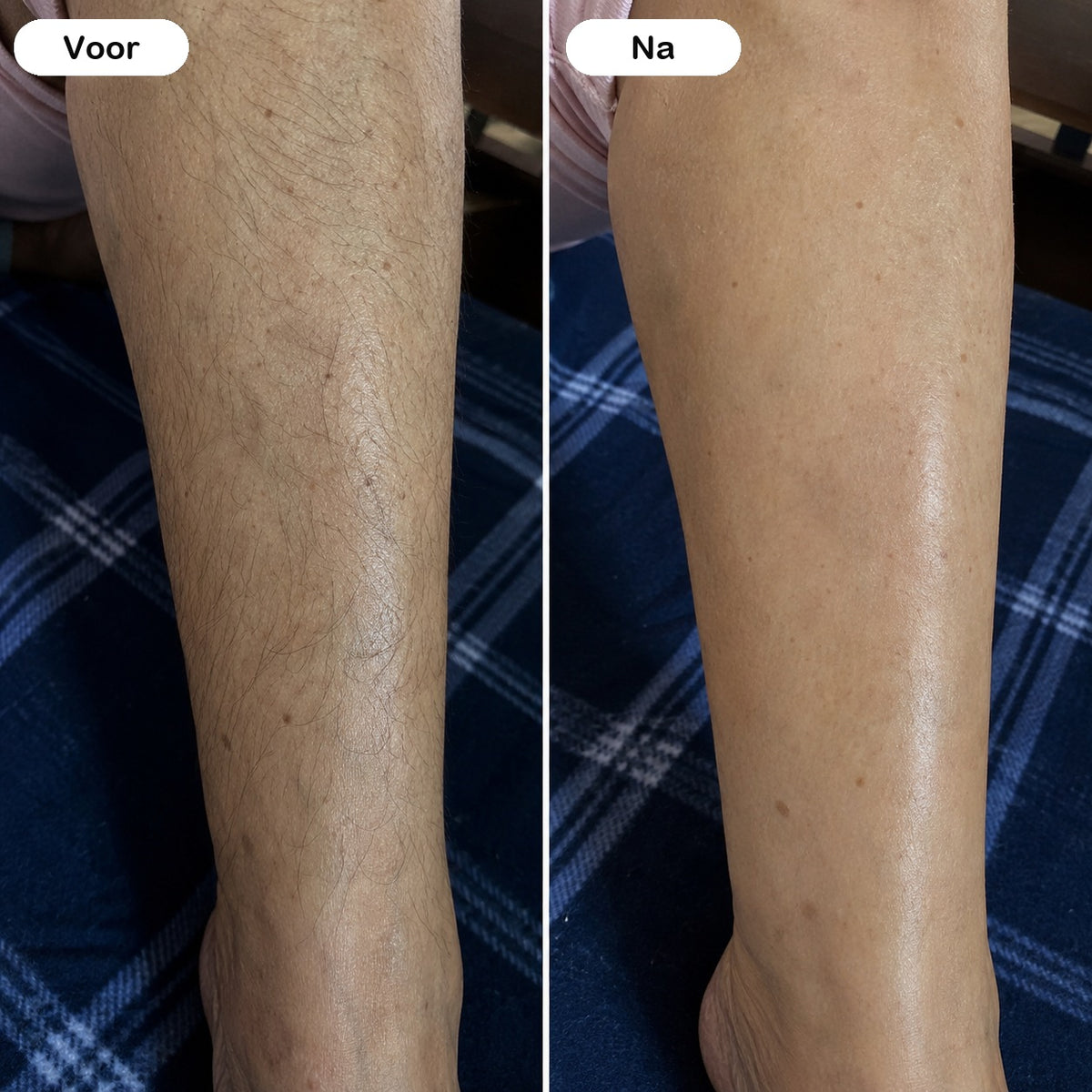 HaarRust ontharingscrème