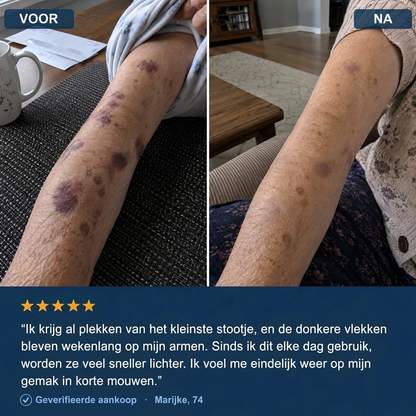 HuidRust crème voor dunne huid
