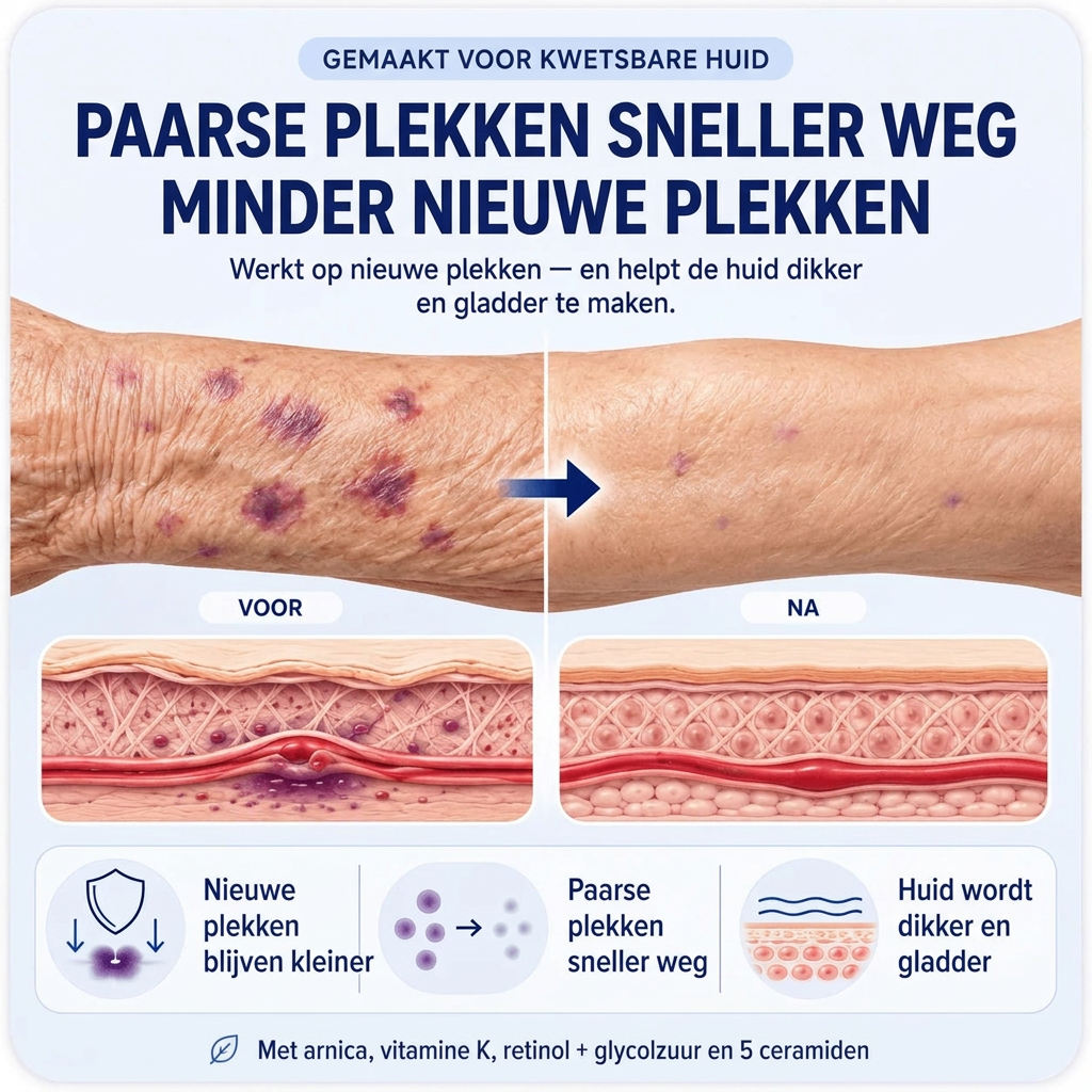 HuidRust crème voor dunne huid