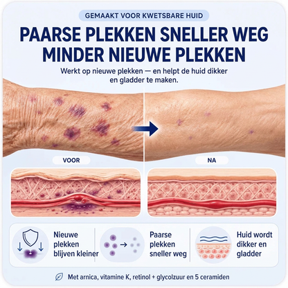 HuidRust crème voor dunne huid