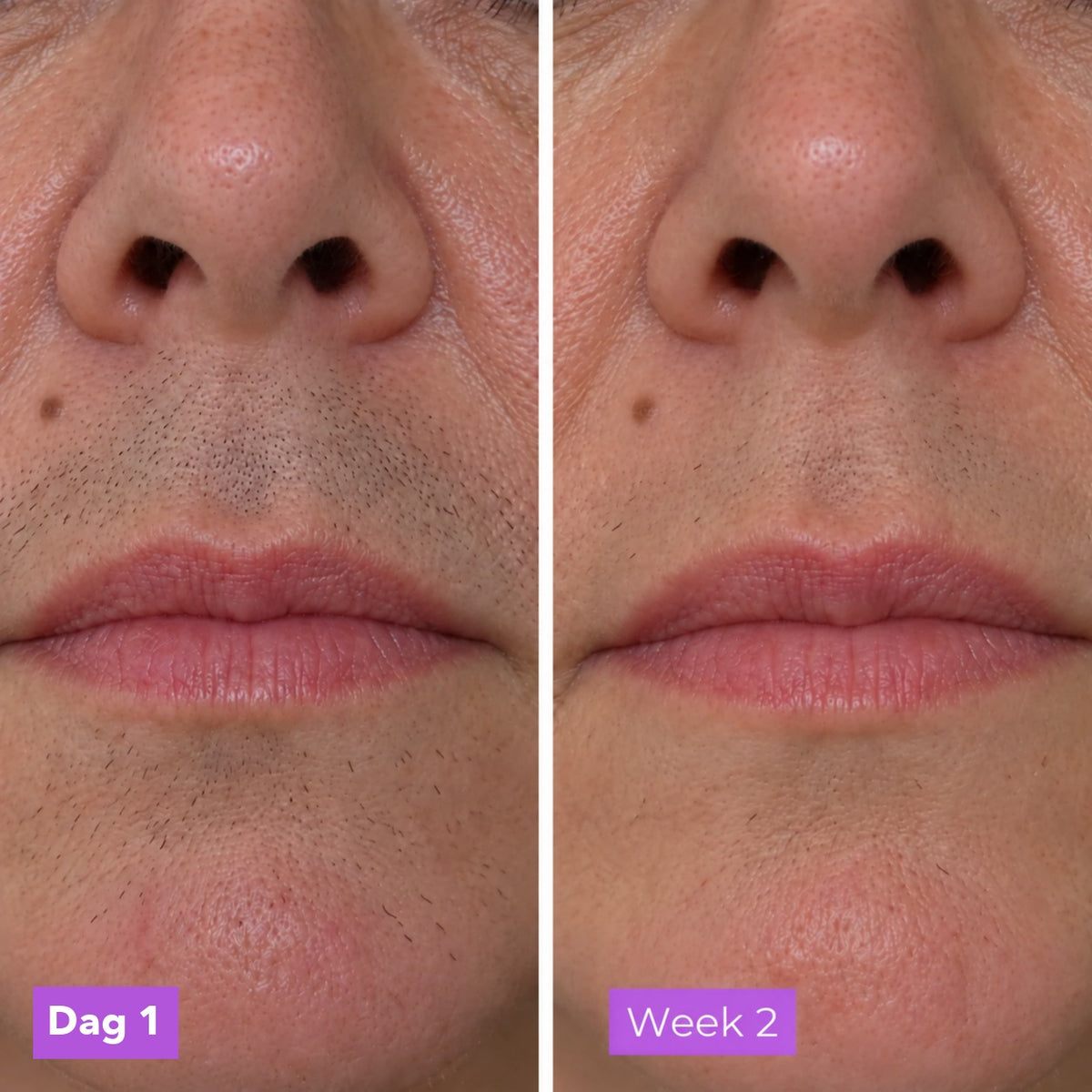 StoppelRust serum