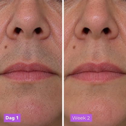 StoppelRust serum